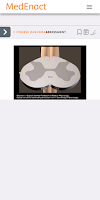 Medenact screenshot 5
