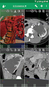 DroidRender - 3D DICOM viewer capture d'écran 1