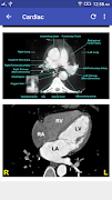 5 Schermata CT Scan Cross Sectional Anatomy