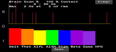 Brain Scan screenshot 4