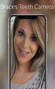 Braces Teeth Camera poster