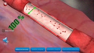 EASY HEART पोस्टर