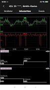 Mindray Mobile Viewer imagem de tela 5