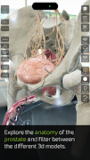 INSIGHT PROSTATE скриншот 4