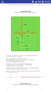 Interpreter un ECG 截图 2