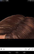 Dandruff screenshot 3