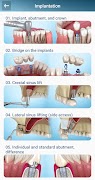 Dental 3D Illustrations screenshot 3