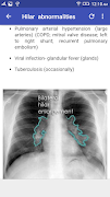 X-Ray Interpretation 截图 3