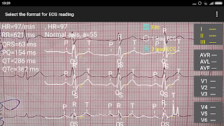 ECG Reader 2 free captura de pantalla 7