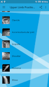 Upper Limb Radiographic Positioning-poster