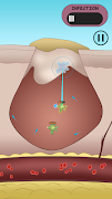 Dermis Defense スクリーンショット 2