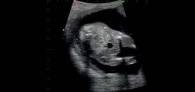 IbexStream screenshot 2