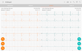 6 Schermata ECG Expert