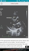 EchoCardio スクリーンショット 5