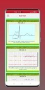 ECG  Interpretation guide captura de pantalla 4