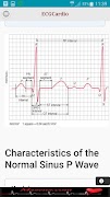 ECGCardio screenshot 5