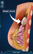 Breast Anatomy Pro. Ekran Görüntüsü 4