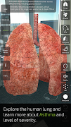 INSIGHT LUNG screenshot 5