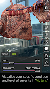 INSIGHT LUNG screenshot 7