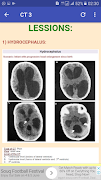 CT Head Basic Interpretation imagem de tela 4