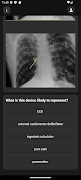 Basic Radiology screenshot 5