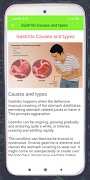 Gastric Problem Ekran Görüntüsü 2