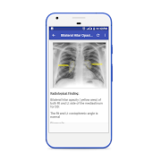 X-Ray Interpretation Guide 海報