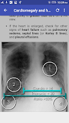 7 Schermata Chest X-Ray Interpretation