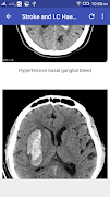 برنامه‌نما CT Brain Interpretation عکس از صفحه
