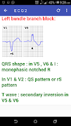 Basic ECG Guide ภาพหน้าจอ 2
