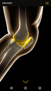 Opulent Knee poster