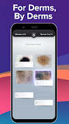 1 Schermata Top Derm: Dermatology Game