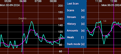 Juggluco スクリーンショット 2
