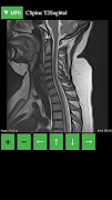 MRI Viewer screenshot 2