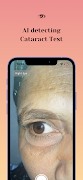 Cataract AI 스크린샷 4