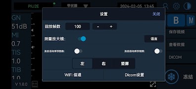 Uscan Pro ภาพหน้าจอ 2