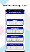 ECG / EKG Learning Guide স্ক্রিনশট 4