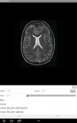 LEADTOOLS DICOM Viewer App ภาพหน้าจอ 3