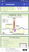A to Z ECG Interpretation captura de pantalla 1