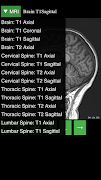 MRI Viewer screenshot 4