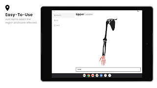 Fractures ảnh chụp màn hình 4