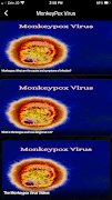 Monkeypox Ekran Görüntüsü 7