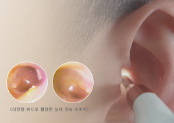 RefitCam Medi Ekran Görüntüsü 5