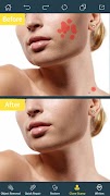 Photo Retouch- Object Removal screenshot 1