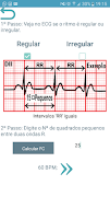 ECG Report Screenshot 2