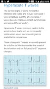 ECG Basics - Full screenshot 3