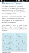 ECG Basics - Full screenshot 3