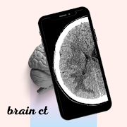 CT Brain स्क्रीनशॉट 1