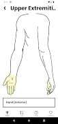 Nerve Block 截图 2