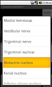 NeuroSlice screenshot 2